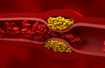 غذاء مثالي يساعد على تقليل الكوليسترول الضار عند تناوله يوميا غذاء مثالي يساعد على تقليل الكوليسترول الضار عند تناوله يوميا