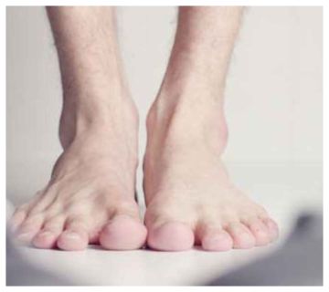 7 علامات على القدمين .. مؤشر لمشاكل صحية خطيرة