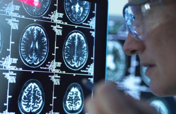 اكتشاف آلية ثورية لمكافحة ألزهايمر باستخدام مادة طبيعية في الجسم اكتشاف آلية ثورية لمكافحة ألزهايمر باستخدام مادة طبيعية في الجسم