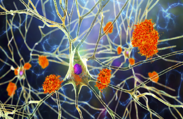  النبات المعجزة .. مفتاح جديد لعلاج ألزهايمر