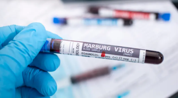 ظهور فيروس ماربورغ القاتل في إثيوبيا .. منظمة الصحة العالمية تعلن حالة استنفار ظهور فيروس ماربورغ القاتل في إثيوبيا .. منظمة الصحة العالمية تعلن حالة استنفار