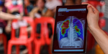 الصحة العالمية: وفاة أكثر من مليون شخص بهذا المرض الصحة العالمية: وفاة أكثر من مليون شخص بهذا المرض