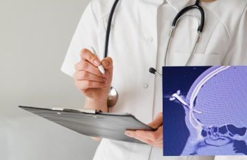 مفتاح سيارة يستقر في جبينه.. لاعب سابق يتعرض لإصابة غريبة