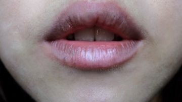 ودعي تشقق الشفاه.. أفضل الطرق الطبيعية والفعالة لترطيبها وحمايتها ودعي تشقق الشفاه.. أفضل الطرق الطبيعية والفعالة لترطيبها وحمايتها