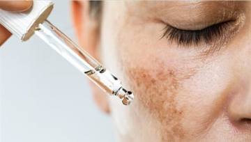 7 عادات يومية تزيد فرط التصبغ وتؤخر علاج البقع الداكنة 7 عادات يومية تزيد فرط التصبغ وتؤخر علاج البقع الداكنة