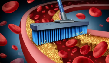 5 علامات تحذيرية و5 أسباب لارتفاع الكوليسترول بالجسم