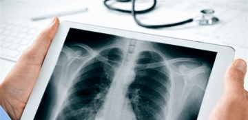 الأشعة السينية.. أداة تشخيص لا غنى عنها ومخاوف مبالغ فيها الأشعة السينية.. أداة تشخيص لا غنى عنها ومخاوف مبالغ فيها