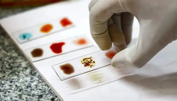 الدم الذهبي: تعرف على سحر فصيلة الدم الأندر في العالم الدم الذهبي: تعرف على سحر فصيلة الدم الأندر في العالم