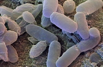 كيف تؤثر البكتيريا المنزلية على صحتنا؟