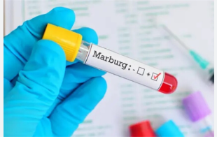 بعد انتشار الشائعات .. وزارة الصحة المصرية تؤكد: فيروس ماربورغ لا يهدد مصر