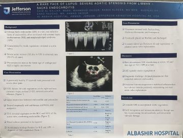 إنجاز طبي أردني جديد في مستشفى البشير ينشر في مجلة Circulation العالمية