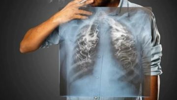 هل يرفع التدخين عبء الانسداد الرئوي عند الأردنيين؟