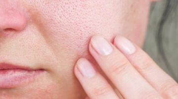 دليلك لعلاج المسام الواسعة والحصول على بشرة مشدودة ونضرة دليلك لعلاج المسام الواسعة والحصول على بشرة مشدودة ونضرة