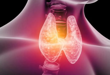 ما سر زيادة حالات الإصابة بسرطان الغدة الدرقية حول العالم؟ ما سر زيادة حالات الإصابة بسرطان الغدة الدرقية حول العالم؟