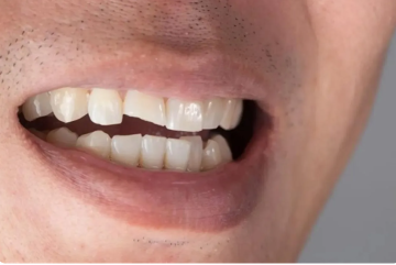 اكتشف مثير يربط بين علاج التهابات الأسنان والقلب والسكري !