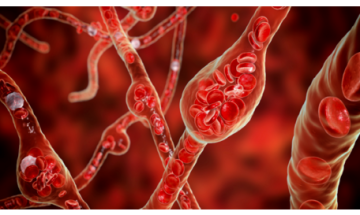 4 حقائق عن الكوليسترول لا ينبغي تجاهلها 4 حقائق عن الكوليسترول لا ينبغي تجاهلها