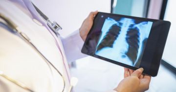 اختتام ورشة فحوصات ضبط الجودة بالأشعة التشخيصية