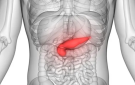 اكتشاف عامل خطر غير متوقع لسرطان البنكرياس