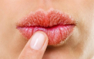 وصفات طبيعية للتخلص من تشققات الشفاه