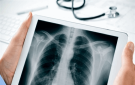 الأشعة السينية.. أداة تشخيص لا غنى عنها ومخاوف مبالغ فيها