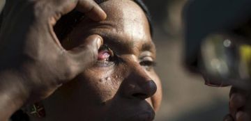 العمى النهري.. مرض خطير ينتشر في هذه الدول!