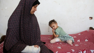 صحة غزة: 6 آلاف حالة بتر في القطاع بحاجة لبرامج تأهيل عاجلة