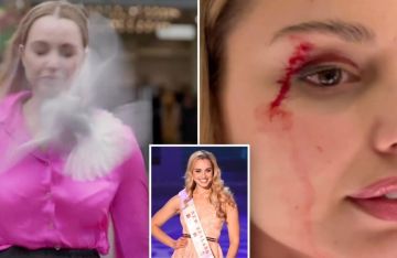 طائر يصطدم بوجه مراسلة نيوزيلاندية على المباشر ويصيبها بجروح (فيديو) طائر يصطدم بوجه مراسلة نيوزيلاندية على المباشر ويصيبها بجروح (فيديو)