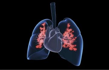 عدوى رئوية شائعة ترفع خطر الإصابة بأمراض القلب