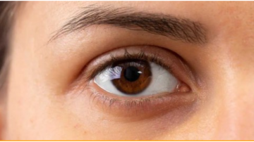 كيف تكشف الكلى عن نفسها عبر الوجه؟ علامات تحذيرية لا تتجاهلها كيف تكشف الكلى عن نفسها عبر الوجه؟ علامات تحذيرية لا تتجاهلها