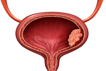 فيروس شائع في الطفولة قد يزيد خطر سرطان المثانة