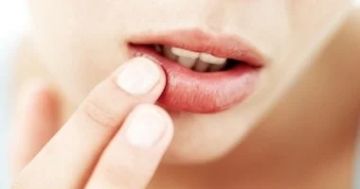 نصائح سريعة للتخلص من تشقق الشفاه في الشتاء خلال 3 أيام نصائح سريعة للتخلص من تشقق الشفاه في الشتاء خلال 3 أيام