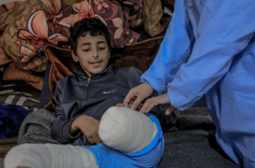 6 آلاف حالة بتر في غزة بحاجة لبرامج تأهيل عاجلة 6 آلاف حالة بتر في غزة بحاجة لبرامج تأهيل عاجلة