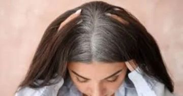 وصفة طبيعية للتخلص من خصلات الشعر الأبيض