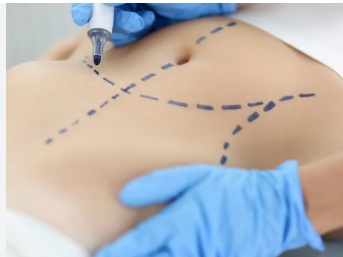 ضبط مركز تجميل في عمان يستخدم حقن NAD غير مرخصة من قبل الغذاء والدواء