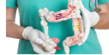 التصبغات من بينها: 5 علامات لسرطان القولون تظهر على الجلد التصبغات من بينها: 5 علامات لسرطان القولون تظهر على الجلد