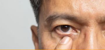 للوقاية من التأثير المدمر للغلوكوما.. اليكم آخر ما توصل اليه العلماء للوقاية من التأثير المدمر للغلوكوما.. اليكم آخر ما توصل اليه العلماء