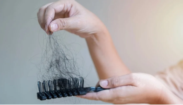 دراسة تكشف كيف يسبب التوتر تساقط الشعر دراسة تكشف كيف يسبب التوتر تساقط الشعر