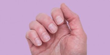 تغيرات في الأظافر والجلد قد تنذر بمرض كبدي خطير تغيرات في الأظافر والجلد قد تنذر بمرض كبدي خطير