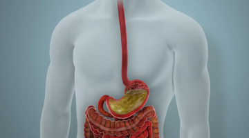 هذا ما يفعله الإفراط في البروتين بأمعائك هذا ما يفعله الإفراط في البروتين بأمعائك