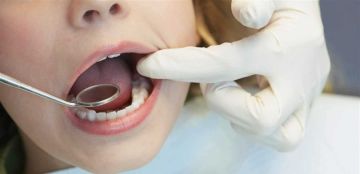 تعطيل لغة البكتيريا يفتح بابا جديدا للوقاية من تسوس الأسنان