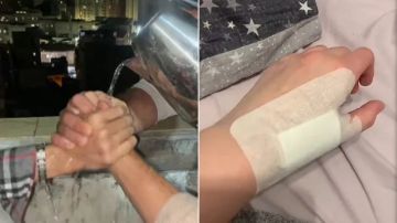 ترند .. كيف تحولت إثباتات الصداقة إلى كارثة صحية