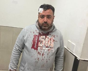 الأجهزة الأمنية تحقق بجريمة الاعتداء على الصحفي التميمي