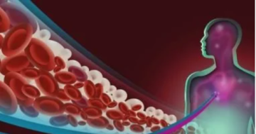 أعراض ارتفاع الدهون الثلاثية وطرق الوقاية والعلاج