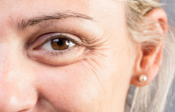 كيف تكشف تجاعيد العينين أسرار صحة الدماغ