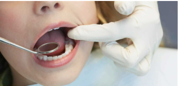 تعطيل لغة البكتيريا يفتح بابا جديدا للوقاية من تسوس الأسنان