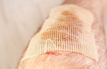 دراسة روسية تكشف ارتباطا بين القلق وتأخر التئام الجروح