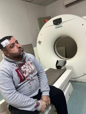 شاهد بالفيديو .. الاعتداء على صحفي وعائلته من قبل ملثمين في الزرقاء شاهد بالفيديو .. الاعتداء على صحفي وعائلته من قبل ملثمين في الزرقاء