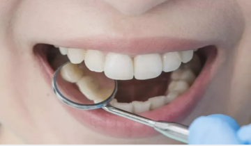 دراسة يابانية صادمة .. عدد أسنانك قد يتنبأ بموعد رحيلك