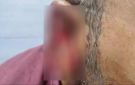 من أسبقية ركوب التاكسي إلى اتهامات متبادلة .. كواليس مشاجرة محامي قويسنا