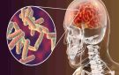 تحذير من مخاطر الالتهاب السحائي وتدعو للالتزام بالتطعيمات